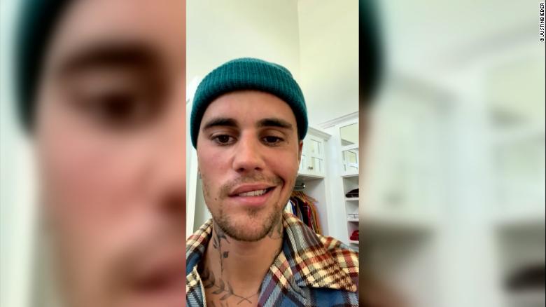 Justin Bieber says he is suffering from facial paralysis